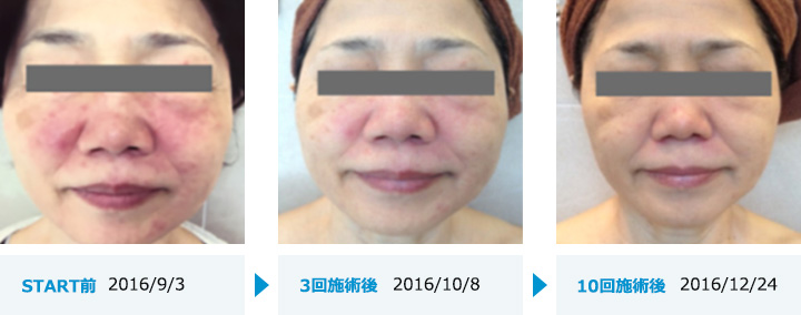 60代女性　KMS様