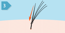 3. 選んだ自毛に増毛用人口毛を通します。