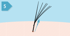 5. 自毛の伸びとともに増毛用人口毛の結び目も上部へ移動します。