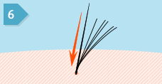 6. 使い捨てではない増毛用人口毛は自毛根元に移動させることができます。